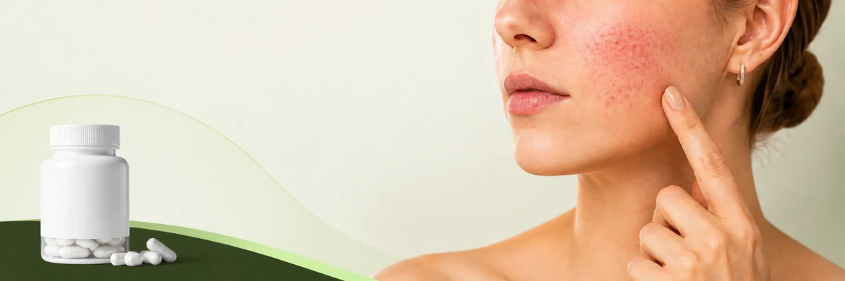 Does KPV for Skin Help With Eczema, Rosacea, and Wound Healing?